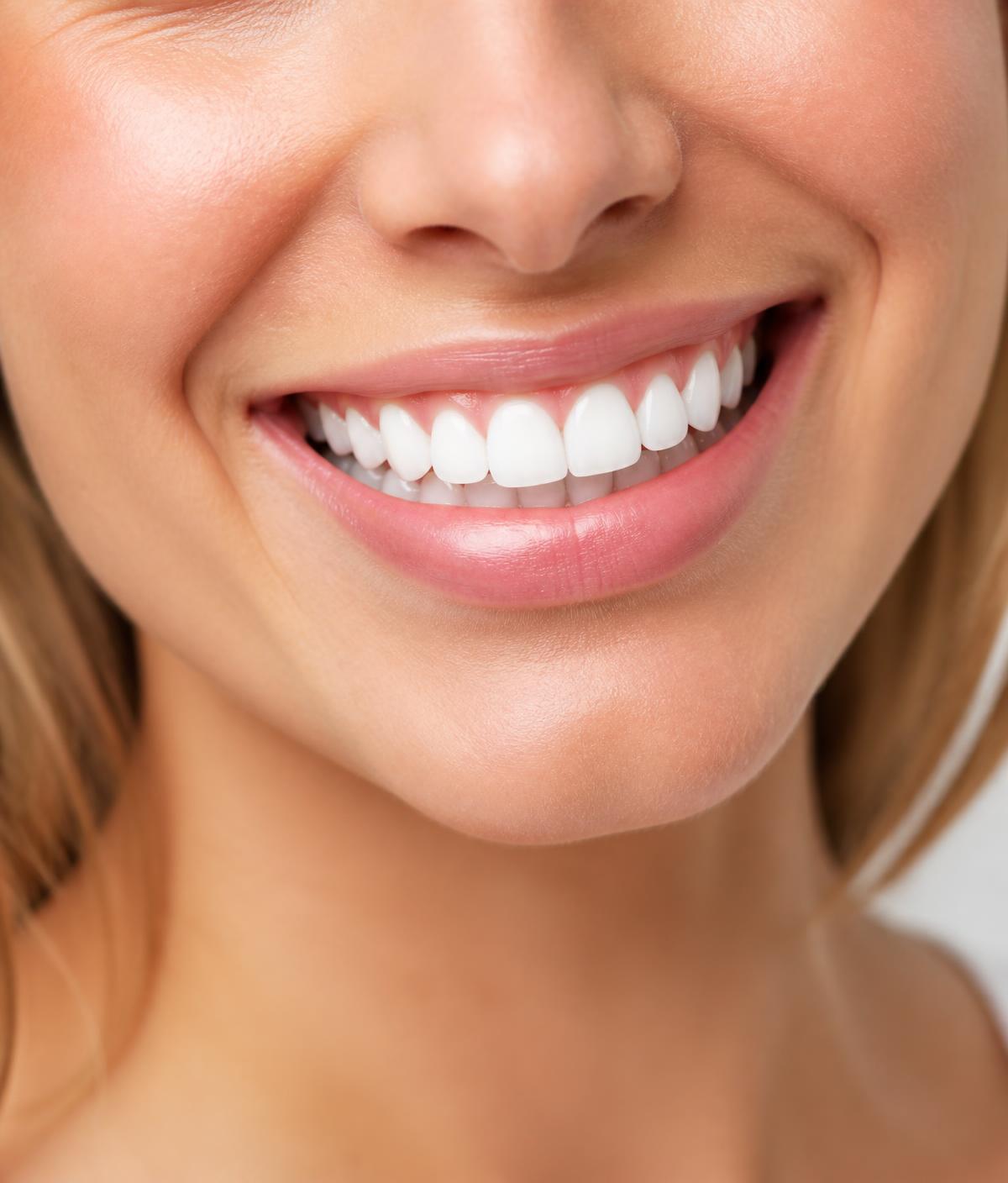 Bright white smile after professional BEYOND whitening